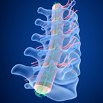 Minimally Invasive Spine Surgery