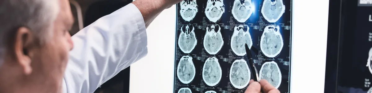 Neurosurgeon reviewing brain MRI scans