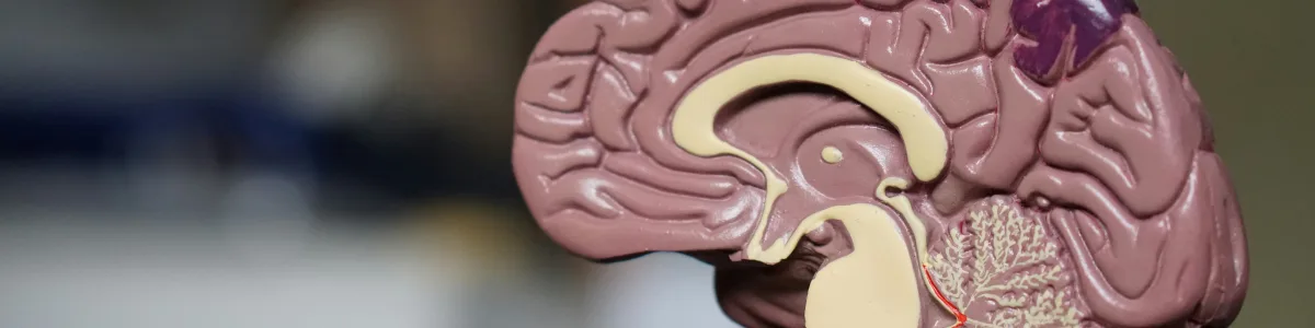 Anatomical brain model